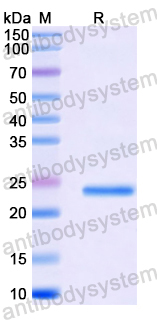 Recombinant Human VTI1A Protein, N-His