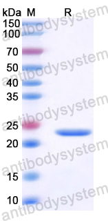 Recombinant Human TIMM29 Protein, N-His