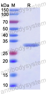 Recombinant Human P2RX5 Protein, N-His