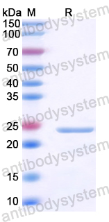 Recombinant Human CHAC1 Protein, N-His
