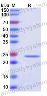 Recombinant Human CHMP1B Protein, N-His