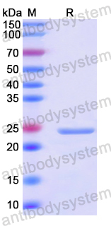 Recombinant Human STARD7 Protein, N-His