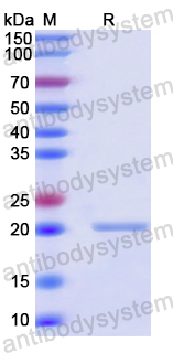 Recombinant Human CHMP6 Protein, N-His