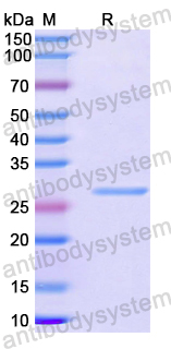 Recombinant Human EXOSC8 Protein, N-His