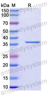 Recombinant Human SCLT1 Protein, N-His