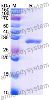 Recombinant Human METRNL/Subfatin Protein, N-His