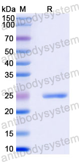 Recombinant Human SH3TC2 Protein, N-His