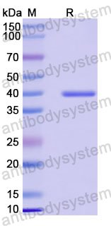 Recombinant Human TRPM7/LTRPC7 Protein, N-His