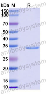 Recombinant Human MFSD8/CLN7 Protein, N-GST & C-His