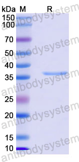 Recombinant Human CLN8 Protein, N-GST & C-His