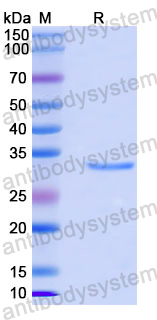 Recombinant Human CLN6 Protein, N-GST & C-His