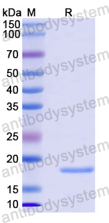 Recombinant Human JPH3/JP-3 Protein, N-His