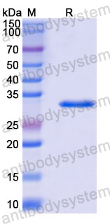 Recombinant Human CHCHD10 Protein, N-GST & C-His