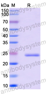 Recombinant Human UNC13D Protein, N-His