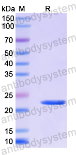 Recombinant Human EAF1 Protein, N-His-SUMO