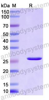 Recombinant Human HBS1L Protein, N-His