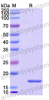Recombinant Human SLC27A3/FATP3 Protein, N-His