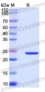 Recombinant Human TMEM70 Protein, N-His-SUMO