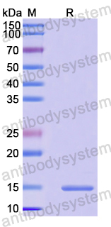 Recombinant Human AMOTL2/LCCP Protein, N-His