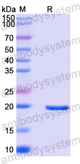 Recombinant Human ORAI2 Protein, N-His-SUMO