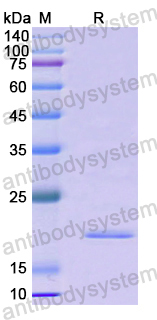 Recombinant Human PHOX2B Protein, N-His-SUMO