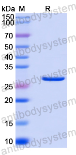 Recombinant Human ANKRD6 Protein, N-His