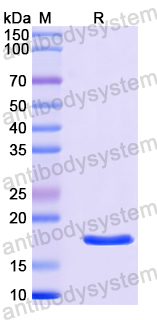 Recombinant Human COX4I2 Protein, N-His-SUMO