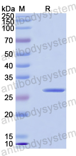 Recombinant Human EXOG Protein, N-His