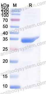 Recombinant Human SLC2A9 Protein, N-GST & C-His