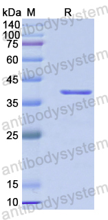 Recombinant Human RAD18 Protein, N-GST & C-His