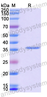Recombinant Human SPATA7 Protein, N-GST & C-His