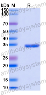 Recombinant Human TRPS1 Protein, N-GST & C-His