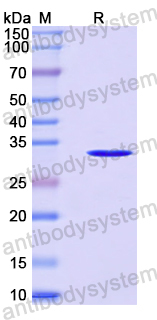 Recombinant Human SLC25A37 Protein, N-GST & C-His