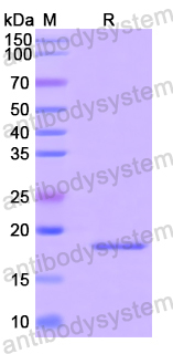 Recombinant Human RANBP9 Protein, N-His