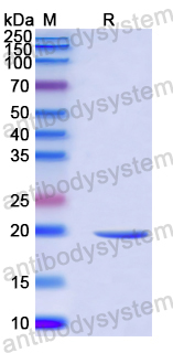 Recombinant Human NDUFAF4 Protein, N-His-SUMO