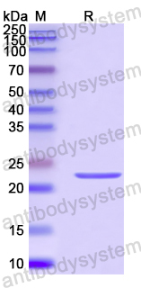 Recombinant Human KRT12 Protein, N-His-SUMO