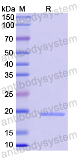 Recombinant Human LYSMD3 Protein, N-His-SUMO