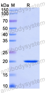 Recombinant Human SORBS1 Protein, N-His