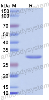 Recombinant Human CEP192 Protein, N-His