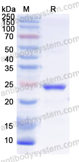 Recombinant Human MUL1 Protein, N-His