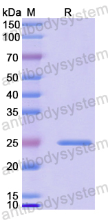 Recombinant Human ALKBH7 Protein, N-His