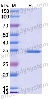 Recombinant Human APH1A Protein, N-GST & C-His