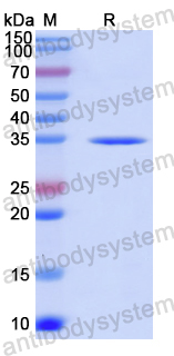 Recombinant Human HLA-F Protein, N-His