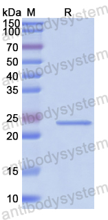 Recombinant Human HLA-DQA1 Protein, N-His