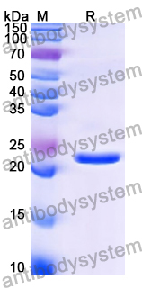 Recombinant Human HLA-DPB1 Protein, N-His
