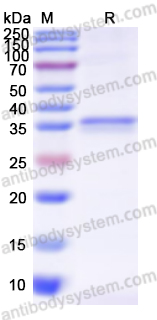 Recombinant Human MUC4 Protein, C-His