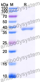 Recombinant Human MAP3K14 Protein, N-His