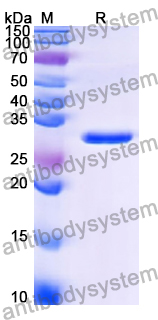 Recombinant Human BBS5 Protein, N-His