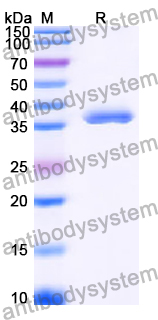 Recombinant Human ERBIN Protein, N-GST & C-His