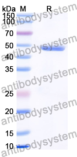 Recombinant Human LRRC4 Protein, N-His